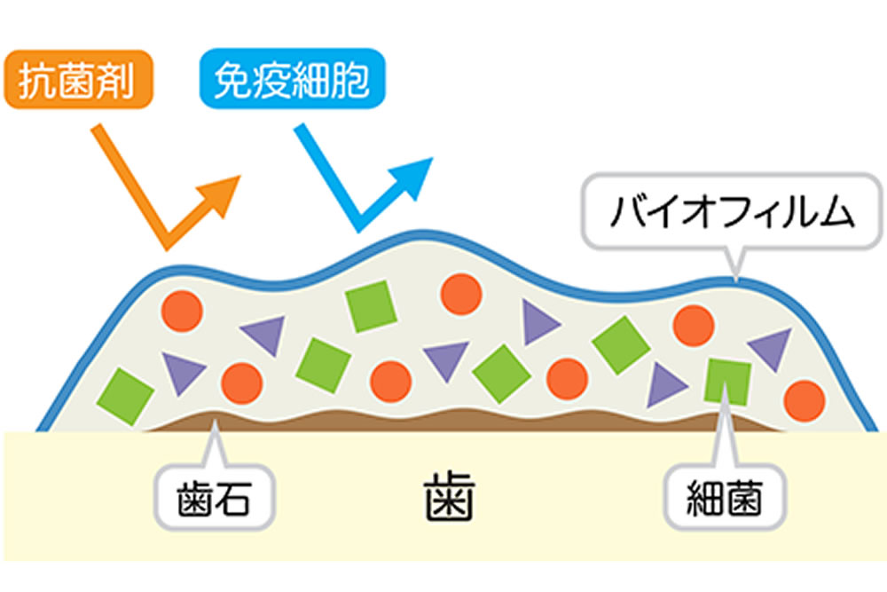 日野市（平山城址公園）の歯医者、SERAデンタルオフィスの予防歯科