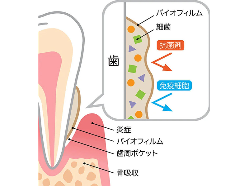 日野市（平山城址公園）の歯医者、SERAデンタルオフィスの予防歯科