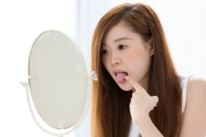 日野市(平山城址公園)の歯医者、SERAデンタルオフィス 平山城址公園駅前歯科で、舌痛症についての解説