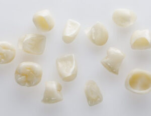 日野市（平山城址公園）の歯医者、SERAデンタルオフィス 平山城址公園駅前歯科で、保険適用の白い歯